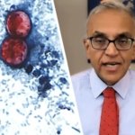 Stomach parasite outbreak source may remain a mystery, expert warns